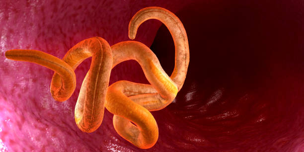 Read more about the article Intestinal Worms (Soil-Transmitted Helminthiases): A Comprehensive Guide to Prevention and Treatment